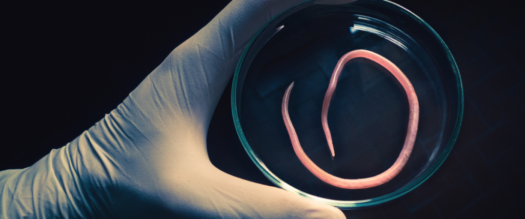 Cyclosporiasis in Houston